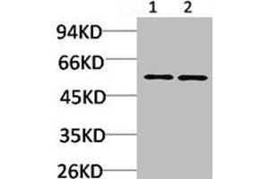 Western blot analysis of 1) Mouse Brain Tissue, 2) Rat Brain Tissue using CACNB3 Polyclonal Antibody.