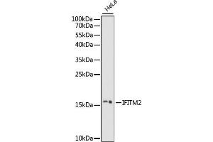 anti-Interferon Induced Transmembrane Protein 2 (IFITM2) (AA 1-100) antibody