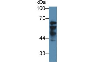 Western blot analysis of Human Liver lysate, using Human IGF2BP2 Antibody (3 µg/ml) and HRP-conjugated Goat Anti-Rabbit antibody ( (IGF2BP2 anticorps  (AA 141-384))