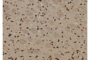 ABIN6276548 at 1/100 staining Rat brain tissue by IHC-P.