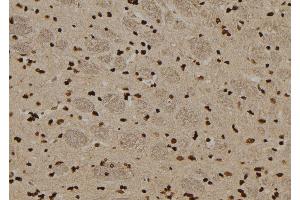 ABIN6276548 at 1/100 staining Rat brain tissue by IHC-P. (TRADD anticorps  (N-Term))