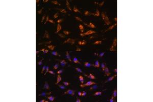 Immunofluorescence analysis of L929 cells using CSF2 antibody (ABIN6130426, ABIN6139094, ABIN6139095 and ABIN6221725) at dilution of 1:100.