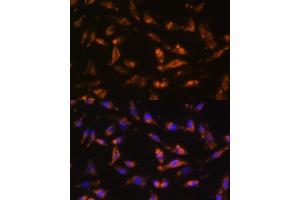 Immunofluorescence analysis of L929 cells using CSF2 antibody (ABIN6130426, ABIN6139094, ABIN6139095 and ABIN6221725) at dilution of 1:100. (GM-CSF anticorps  (AA 18-144))