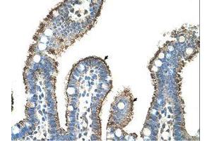 Image no. 1 for anti-Matrix Metallopeptidase 1 (Interstitial Collagenase) (MMP1) (AA 21-70) antibody (ABIN203491) (MMP1 anticorps  (AA 21-70))