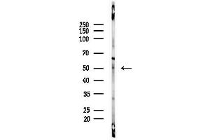 anti-Melanoma Antigen Family C, 2 (MAGEC2) (Internal Region) antibody