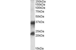 Image no. 1 for anti-Clathrin, Light Chain A (CLTA) (Internal Region), (Light Chain) antibody (ABIN375031) (CLTA anticorps  (Internal Region, Light Chain))