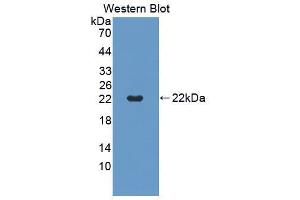 Western blot analysis of the recombinant protein. (CD40 anticorps  (AA 26-193))