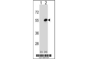 Western blot analysis of COCH using rabbit polyclonal COCH Antibody using 293 cell lysates (2 ug/lane) either nontransfected (Lane 1) or transiently transfected (Lane 2) with the COCH gene. (COCH anticorps  (AA 399-428))