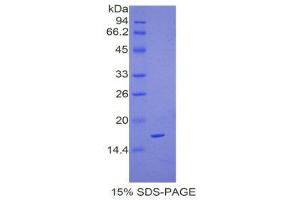 SDS-PAGE (SDS) image for Complexin 2 (CPLX2) (AA 1-134) protein (His tag) (ABIN2120887)