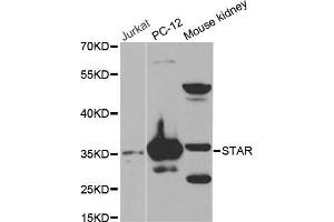 Western blot analysis of extracts of various cell lines, using STAR antibody. (STAR anticorps  (AA 64-285))