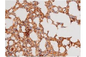 ABIN6267579 at 1/200 staining Mouse lung tissue sections by IHC-P.