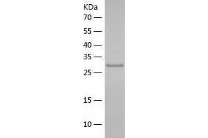 Western Blotting (WB) image for DNA-Damage Inducible 1 Homolog 1 (DDI1) (AA 33-326) protein (His tag) (ABIN7122688)