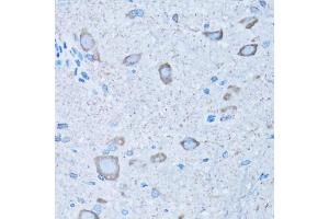 Immunohistochemistry of paraffin-embedded mouse spinal cord using NNMT antibody (ABIN5974021) at dilution of 1/100 (40x lens). (NNMT anticorps)