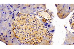 Detection of SPR in Mouse Pancreas Tissue using Polyclonal Antibody to Sepiapterin Reductase (SPR)