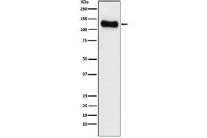 Western blot analysis of SAP97 expression in SH-SY5Y cell lysate.