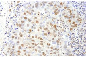 anti-Scaffold Attachment Factor B (SAFB) (C-Term) antibody