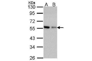 WB Image Sample (30 ug of whole cell lysate) A: A431 , B: H1299 10% SDS PAGE antibody diluted at 1:1000 (CORO1C anticorps  (C-Term))