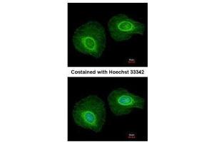 ICC/IF Image Immunofluorescence analysis of methanol-fixed HeLa, using Cytokeratin 34, antibody at 1:200 dilution. (Keratin 34 anticorps)