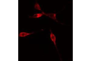 ABIN6274781 staining COLO205 cells by IF/ICC.
