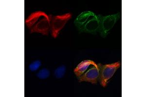 ABIN6262625 and ABIN6268687 staining Hela by IF/ICC. (IL2 Receptor beta anticorps  (N-Term))