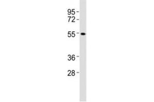 Western blot testing of CB1 antibody at 1:2000 dilution + A431 lysate