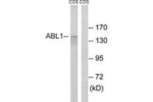 Western blot analysis of extracts from COS7 cells, treated with calyculinA 50ng/ml 30', using ABL1 (Ab-735) Antibody. (ABL1 anticorps  (AA 701-750))