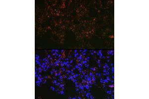 Immunofluorescence analysis of rat lung cells using NAPSA Rabbit pAb (ABIN6128367, ABIN6144368, ABIN6144369 and ABIN6221232) at dilution of 1:100 (40x lens).