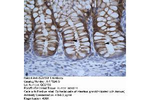 Human Intestine (SUV39H1 anticorps  (C-Term))