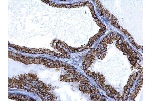 IHC-P Image ALDH2 antibody detects ALDH2 protein at mitochondria on mouse prostate by immunohistochemical analysis.