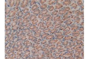 IHC-P analysis of Rat Liver Tissue, with DAB staining. (CTGF anticorps)