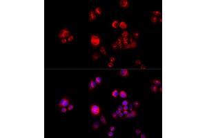 Immunofluorescence analysis of HeLa cells using GLUD2 antibody (ABIN2562844) at dilution of 1:100 (40x lens). (GLUD2 anticorps)