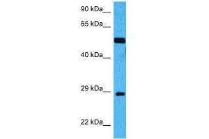 Host:  Mouse  Target Name:  MECP2  Sample Tissue:  Mouse Skeletal Muscle  Antibody Dilution:  1ug/ml (MECP2 anticorps  (Middle Region))