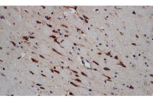 Immunohistochemistry of paraffin-embedded Mouse brain using ERG Polyclonal Antibody at dilution of 1:50 (ERG anticorps)