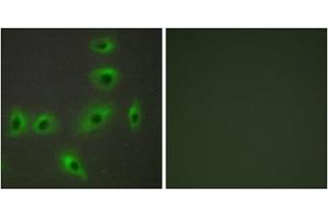 Immunofluorescence analysis of HUVEC cells, using BAX antibody.