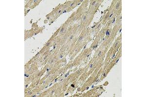 Immunohistochemistry of paraffin-embedded rat heart using SMN2 antibody.