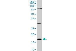 CFL1 monoclonal antibody (M04), clone 1A1.
