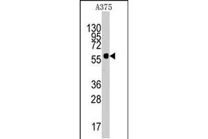 Western blot analysis of KREMEN1 polyclonal antibody  in A-375 cell line lysates (35 ug/lane). (KREMEN1 anticorps  (N-Term))