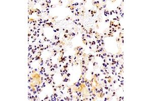Immunohistochemistry of paraffin embedded mouse lung using TFIIIC110 (ABIN7074038) at dilution of 1:2500 (400x lens)