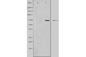 Western blot analysis of extracts from 293 cells, using SLC5A2 antibody. (SLC5A2 anticorps  (N-Term))