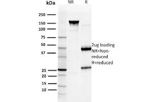 SDS-PAGE Analysis Purified GST Mu3 Mouse Monoclonal Antibody (CPTC- GSTMu3-1).