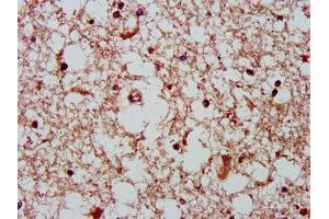 IHC image of ABIN7154521 diluted at 1:400 and staining in paraffin-embedded human brain tissue performed on a Leica BondTM system.