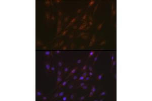 Immunofluorescence analysis of C6 cells using ASC/TMS1 Rabbit pAb (ABIN7269756) at dilution of 1:100 (40x lens).