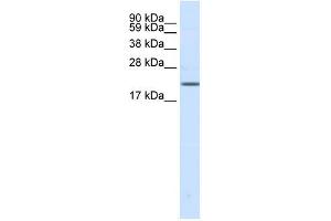 Western Blot showing SCN3B antibody used at a concentration of 1-2 ug/ml to detect its target protein. (SCN3B anticorps  (N-Term))
