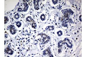 Image no. 4 for anti-Nibrin (NBN) (AA 461-754) antibody (ABIN1491539)