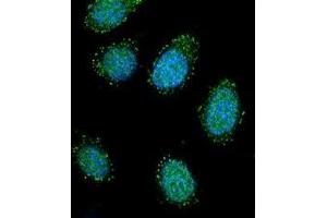 Confocal immunofluorescent analysis of DTNA / DRP3 Antibody (C-term) Cat. (DTNA anticorps  (C-Term))