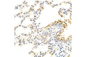Immunohistochemistry analysis of paraffin-embedded rat lung using Eif2ak1 (ABIN7073875) at dilution of 1: 1000 (EIF2AK1 anticorps)