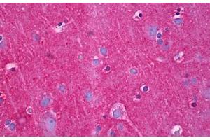 Anti-NDRG4 antibody IHC staining of human brain, cortex neuropil.