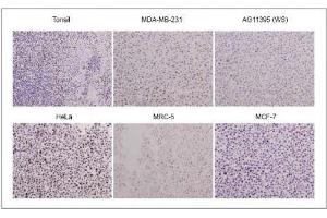 WRN antibody (mAb) tested by Immunohistochemistry. (RECQL2 anticorps)