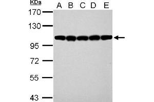WB Image CSE1L antibody detects CSE1L protein by western blot analysis. (Exportin 2 anticorps  (Center))