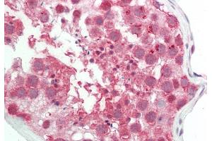 Rabbit Anti-CLPTM1L antibody  Formalin Fixed Paraffin Embedded Tissue: Human Testis Primary antibody Concentration: 1:100 Secondary Antibody: Donkey anti-Rabbit-Cy3 Secondary Antibody Concentration: 1:200 Magnification: 20x Exposure Time: 0.